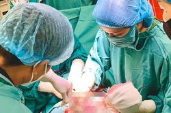 Hai em bé chào đời cùng vòng tránh thai của mẹ