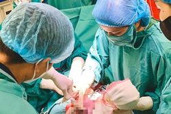 Hi hữu: 1 buổi sáng, 2 em bé chào đời cùng vòng tránh thai của mẹ