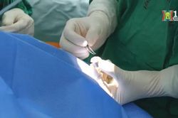 Trên 300.000 người đang chờ ghép giác mạc