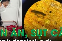 Kém ăn, sụt cân, bé trai 7 tuổi phát hiện bị sán dây chuột