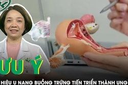 Dấu hiệu u nang buồng trứng tiến triển thành ung thư