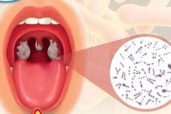Chủ động công tác phòng, chống bệnh bạch hầu cho học sinh tại các cơ sở đào tạo