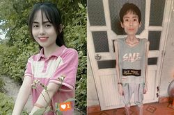 Cô gái Hưng Yên nặng 18kg sau nhiều năm không ăn cơm để giảm cân