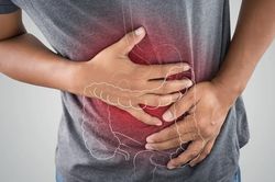 Dấu hiệu sớm cảnh báo ung thư đại trực tràng