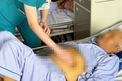 Phá hủy lá gan nghiêm trọng vì uống thuốc sai cách