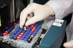 Phương pháp điều trị tiên tiến mang lại hy vọng chấm dứt AIDS vào năm 2030