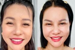 Cát Phượng công khai ảnh sau khi 'đụng chạm dao kéo', gương mặt khác hẳn