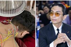 Phan Hiển khiến fan lo khi chia sẻ ảnh 'dây điện' đầy người