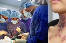 Lần đầu ghép khí quản thành công từ người cho chết não