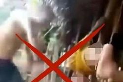 Giám đốc Công an tỉnh Phú Thọ chỉ đạo làm rõ thông tin bé trai nghi bị bạo hành trên mạng xã hội
