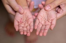 Một trong các loại virus lây lan nhanh nhất ở người