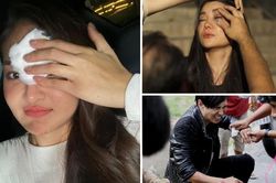 Thùy Anh phải khâu trán, Trúc Anh 'Mắt biếc' rơi khỏi xe và sao Việt gặp tai nạn trên phim trường