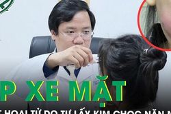 Tự lấy kim chọc mụn rồi dùng tay nặn cô gái trẻ suýt hoại tử mặt