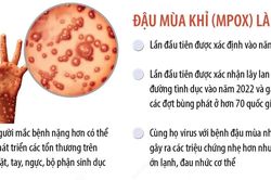 Những điều cần biết về bệnh đậu mùa khỉ hiện nay