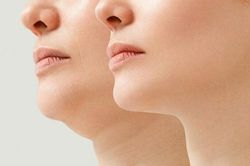 Bài tập giúp bạn thoát tình trạng cằm đôi khó chịu