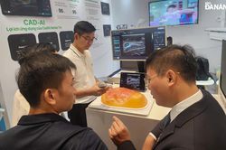 Tăng cường ứng dụng trí tuệ nhân tạo trong y tế