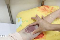 Hà Nội: Số ca mắc sốt xuất huyết trên địa bàn đã có dấu hiệu giảm