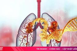 Thuốc điều trị ung thư phổi của Hàn Quốc lần đầu tiên được FDA phê chuẩn