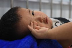 Tốc độ lây lan 'đáng sợ' của virus sởi