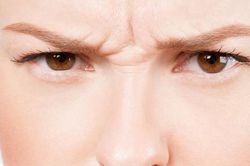 8 cách để làm mờ nếp nhăn sống mũi