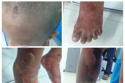 Truy tìm cha của bé trai 6 tuổi nghi bị bạo hành để làm rõ vụ việc