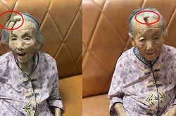 Cụ bà hơn 100 tuổi mọc 'sừng quỷ' và sự thật đau lòng