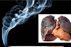 Hút thuốc lá là tác nhân gây ra nhiều bệnh ở phổi