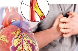 Hút thuốc lá là tác nhân gây nên nhiều bệnh về tim mạch
