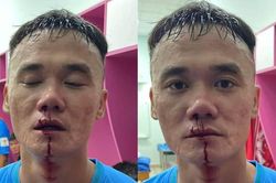 Hai cầu thủ đánh nhau ở giải hạng Nhất chính thức bị phạt nặng