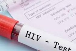 Vai trò của chẩn đoán phân tử trong theo dõi điều trị HIV
