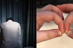 Tại sao ung thư phổi khi phát hiện thường đã ở giai đoạn cuối?
