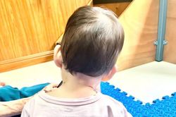 Bé 4 tháng tuổi bị vẹo cổ vì gia đình cho làm việc này quá sớm