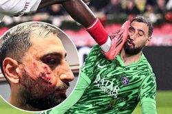 Donnarumma dính chấn thương kinh hoàng ở trận PSG vs Monaco, tranh cãi lớn khi không có thẻ đỏ