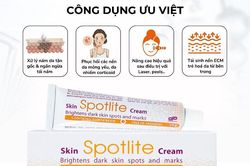 Kem trị nám Spotlite có an toàn cho da nhạy cảm?