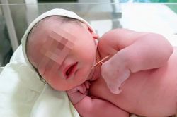 Bé gái chào đời cùng vòng tránh thai của mẹ