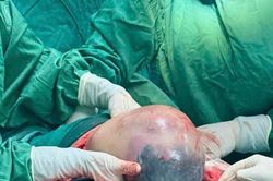 Hy hữu bé trai chào đời vẫn nằm trong bọc ối ở Nghệ An