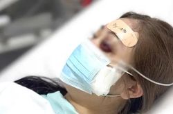 Cô gái bị mù mắt vĩnh viễn do tiêm filler tại nhà