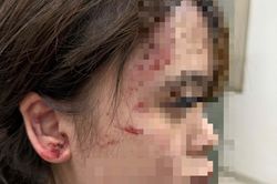 Lời kể của thiếu nữ bị nhóm người đánh hội đồng, bắt quỳ xin lỗi