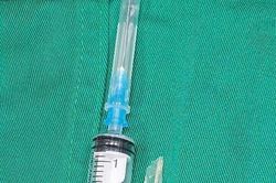 Bé 9 tuổi nuốt phải xương cá khi ăn cháo