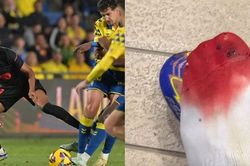Sao trẻ hay nhất Barca đăng tải hình ảnh bàn chân rướm máu, lột tả công tác trọng tài La Liga