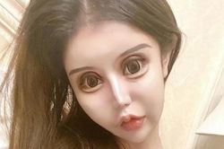 Cô gái dùng gần 14 tỷ đồng của bố mẹ để 'dao kéo' 100 lần