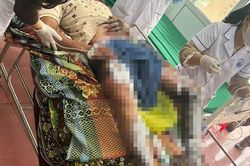 Người đàn ông bị bỏng nặng nghi do điện thoại phát nổ khi sạc