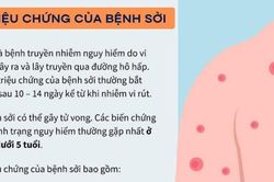 Nghệ An ghi nhận gần 1.100 ca sốt phát ban nghi sởi