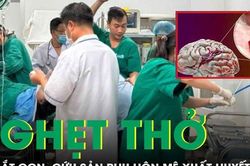 Bác sĩ kể lại giây phút sinh tử giành sự sống cho sản phụ xuất huyết não nguy kịch