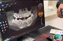 Đi nhổ răng khôn, người phụ nữ qua đời sau một tuần, biết lý do mà đau lòng