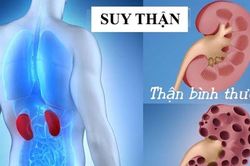 Thận suy yếu âm thầm, 7 việc cần làm ngay để bảo vệ