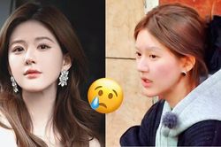 Triệu Lộ Tư đau lòng tuyên bố tạm ngừng diễn xuất vô thời hạn, dù đã hồi phục phần nào