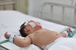 Thời gian ủ bệnh của người mắc sởi