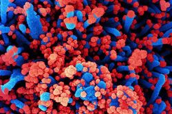 Nga lên tiếng về loại virus chưa xác định gây ra tình trạng ho ra máu