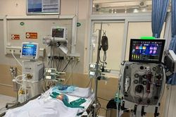 Tưởng chỉ nổi mẩn đỏ bình thường, bé gái 14 tháng tuổi nguy kịch vì tay chân miệng